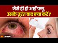 Eye Flu: आई फ्लू होने के बाद तुरंत क्या करें? । Conjunctivitis