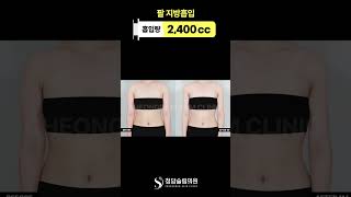 붙는 옷 이제 편하게 입어볼게요.