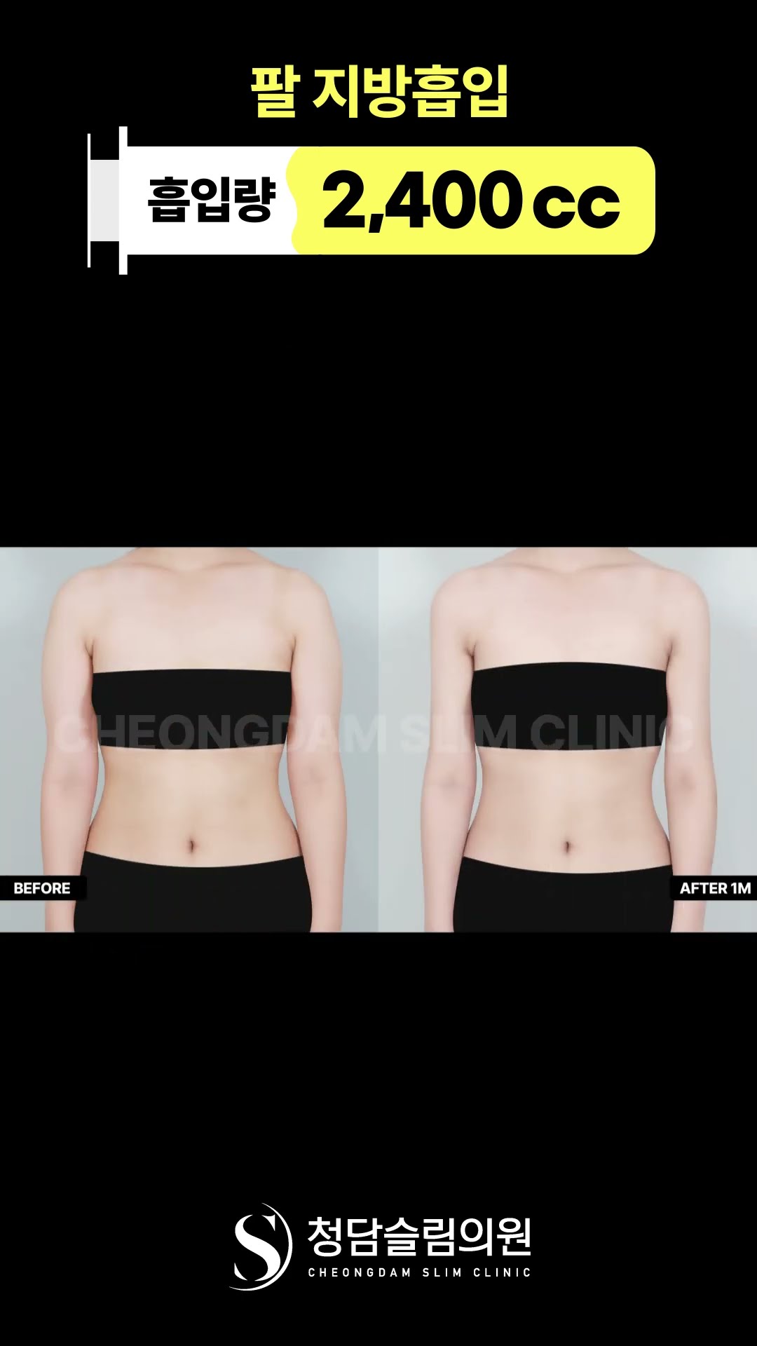 붙는 옷 이제 편하게 입어볼게요.