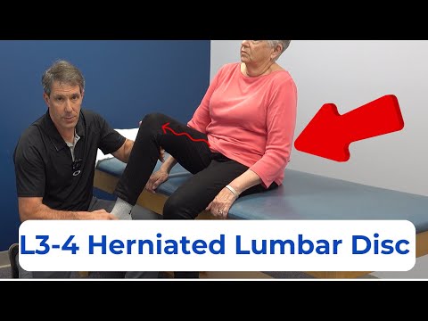 Signs and Symptoms of an L3-4 Lumbar Herniated Disc