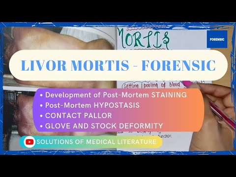 LIVOR MORTIS : Post-Mortem STAINING ||  Forensic and Toxicology
