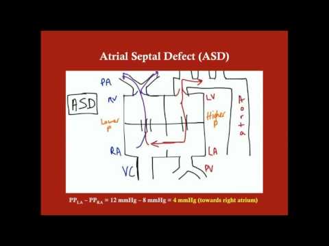 Surgery of Noncyanotic CHDs - CRASH! Medical Review Series