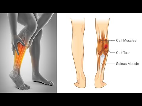 Kopfschmerzen aufgrund Hals Arthritis des Kniegelenks Schwellung