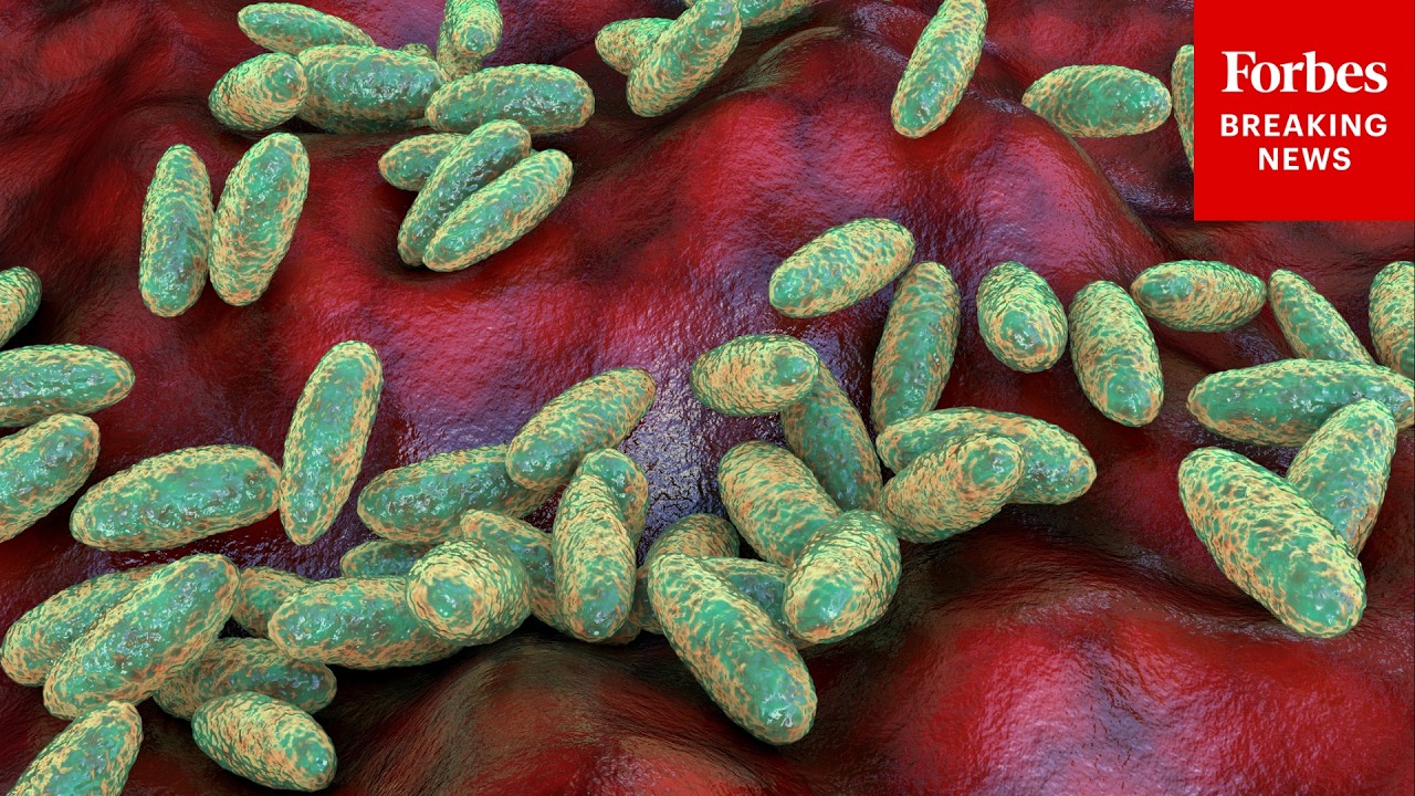 Russian Plague Lab Researcher Dies As Nearly 200 People Monitored—What To Know