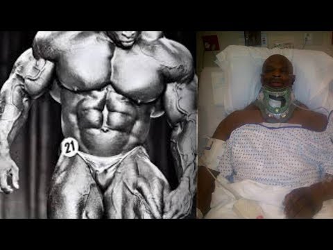 Reasons why Bodybuilders DIE YOUNG
