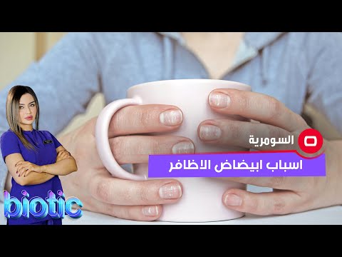 شاهد بالفيديو.. اسباب ابيضاض الاظافر