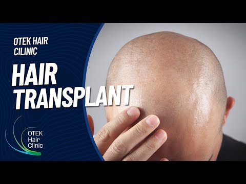 Otek Hair Clinic - Antalya Hair Transplant