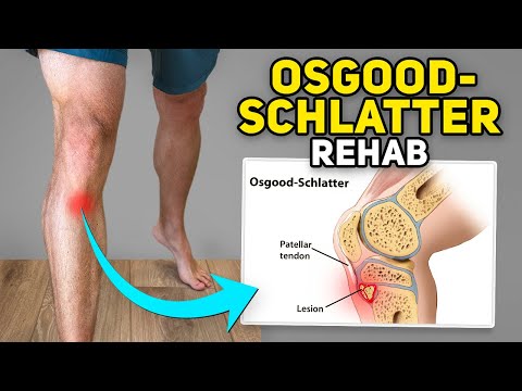 Osgood-Schlatter Disease Rehab Exercises