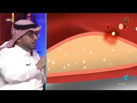 بالفيديو.. استشاري غدد صماء يحذر من الكولسترول: أحد أسباب الوفاة المفاجئة #صحة