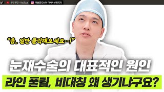 눈 재수술 언제 해야 할까? 눈 재수술 원인과 주의사항 총정리!ㅣ디에이성형외과ㅣ디에이성형외과의원