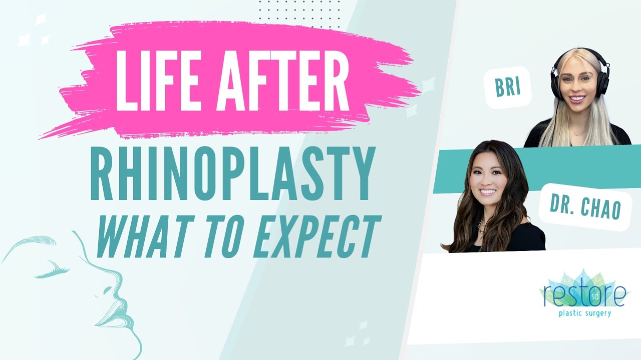Life After Rhinoplasty: What to Expect