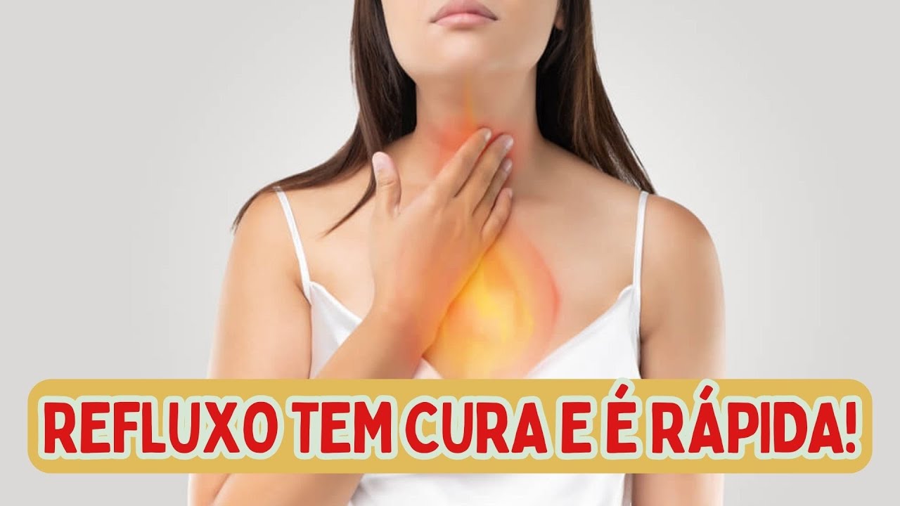 COMO CURAR O REFLUXO SEM REMÉDIO? | Dr Dayan Siebra
