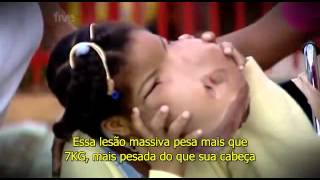 Extraordinary People The Girl With A New Face part 1 LEGENDADO