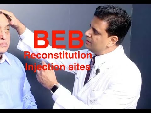 Blepharospasm: Reconstitution of Botox and Injection Sites