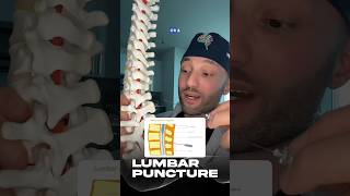 Download lagu This is a spinal tap. #spinaltap #lumbarpuncture #neuro #meningitis #epidural #pregnancy mp3