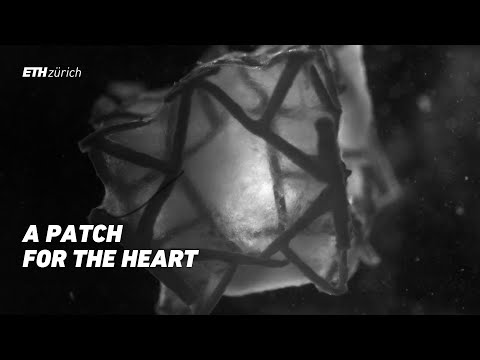 Reinforced Cardiac Tissue