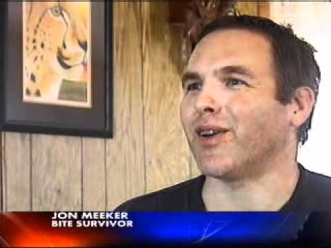 VIDEO: Tiger Bites Baraboo Man - First TV Interview 5pm news 10/29/2010