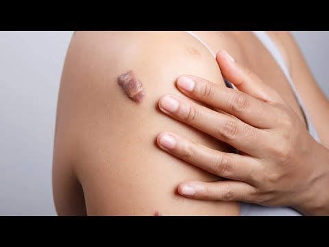 download lagu mp3 mp4 Caloid, download lagu Caloid gratis, unduh video klip Caloid