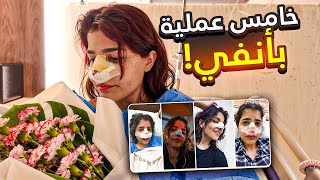 سويت عملية تجميل أنف صورت وأنا مخدرة! فلوق العملية