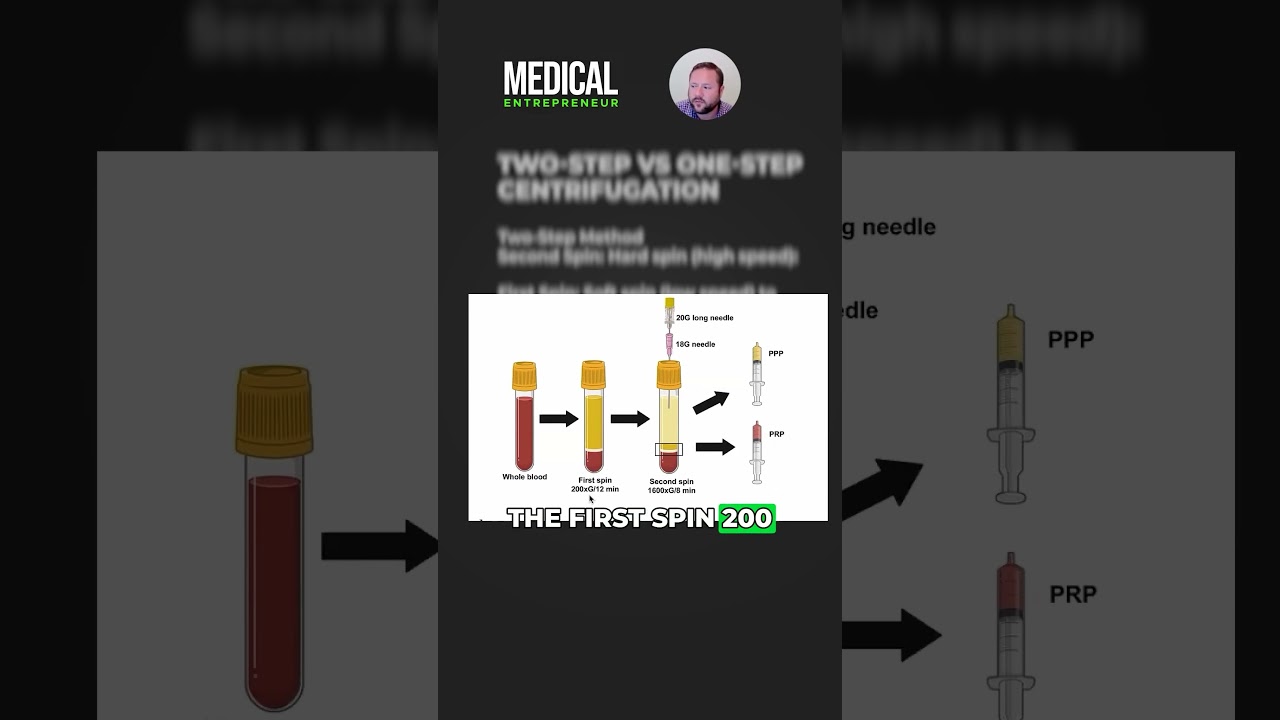 PRP Preparation: One-Step vs. Two-Step Centrifugation