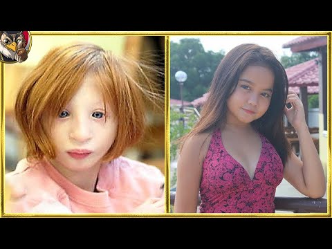 新しい共生の形を発見