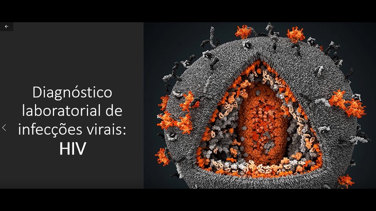 Diagnóstico laboratorial das infecções virais: HIV