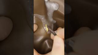 Music video thumbnail preview for Abscess Stab Incision #oddlysatisfying #abscess #vet #medicine #surgery #surgeon #surgeonlife #asmr by Abscess