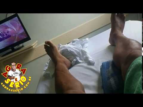 Jornal Agora é Sério vai continuar de molho depois do retorno ao ortopedista , Férias Forçadas devido a cirurgia do joelho !!