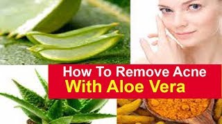 Aloe Vera Acne How To Remove Acne Scars Overnight With Aloe Vera