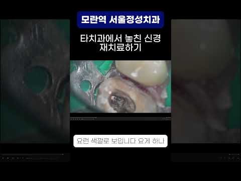 땡큐성형외과 Clips