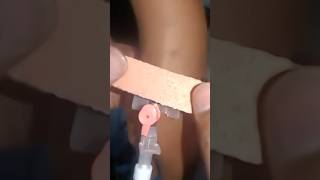 iv Cannulation intravenous cannula, iv cannula #shorts #doctor #viral