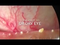 Meibomian gland dysfunction / IPL @ Dry Eyes Los Angeles
