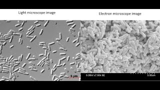 What do bacteria look like under a light vs electron microscope?
