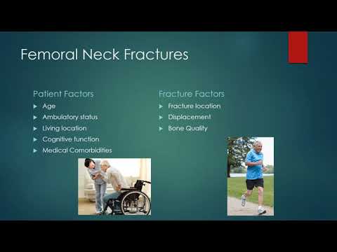 Daniel Mascharenhas, MD: Femoral Neck Fracture Care in Elderly Patients