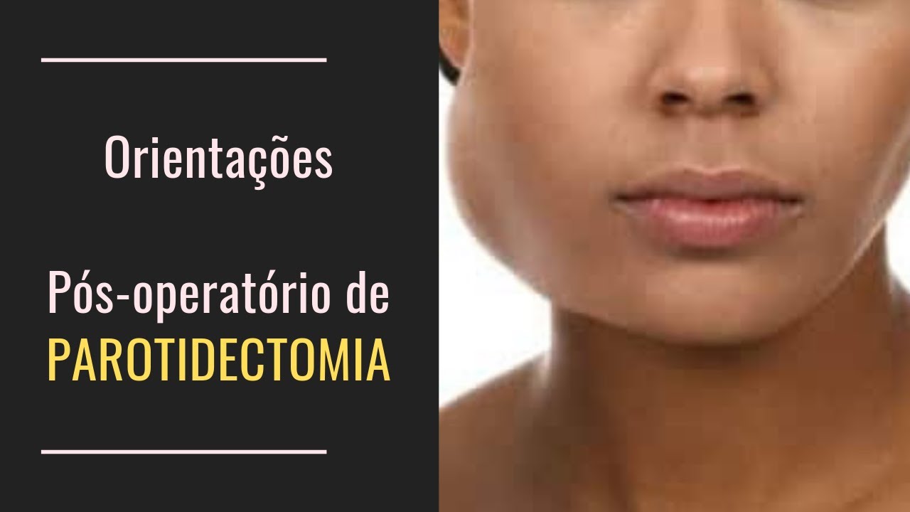 Orientações após parotidectomia - [061]- Dr. Rogério Leite