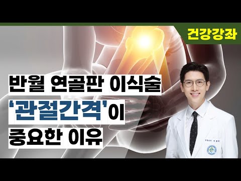 반월연골판이식술에서 관절간격이 중요한 이유