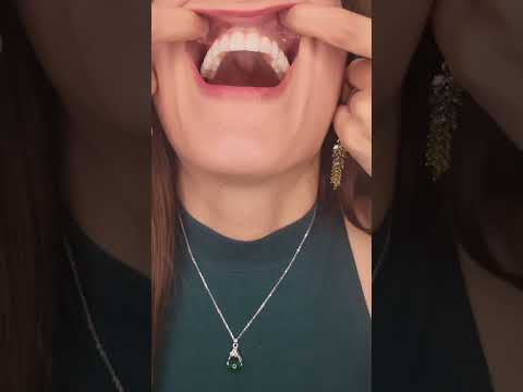 Dental Implants UP CLOSE! #teeth #dentalimplants