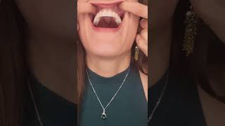 Dental Implants UP CLOSE! #teeth #dentalimplants