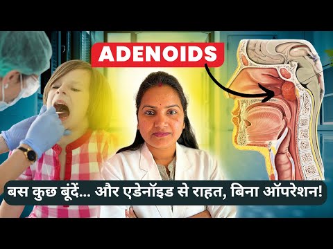 बच्चो में एडिनॉइड्स का इलाज बिना सर्जरी | Cure Adenoids in Kids WITHOUT Surgery