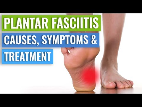 Plantar Fasciitis Causes, Symptoms & Treatment