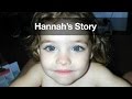 Reaching Out Hannah S Story The Tragic Story Of Abuse As Told By Cook Children S 1 800 4 A CHILD