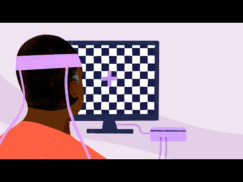 Evoked Potentials Test - Testing for MS