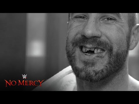 WWE Releases Gruesome Update On Cesaro’s Busted Teeth