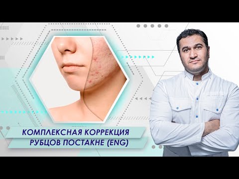 Фракционный лазер MED-X Laser CO2 с RF-модулем - видео