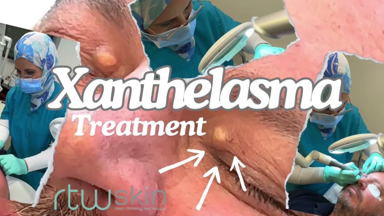 YouTube Video Preview