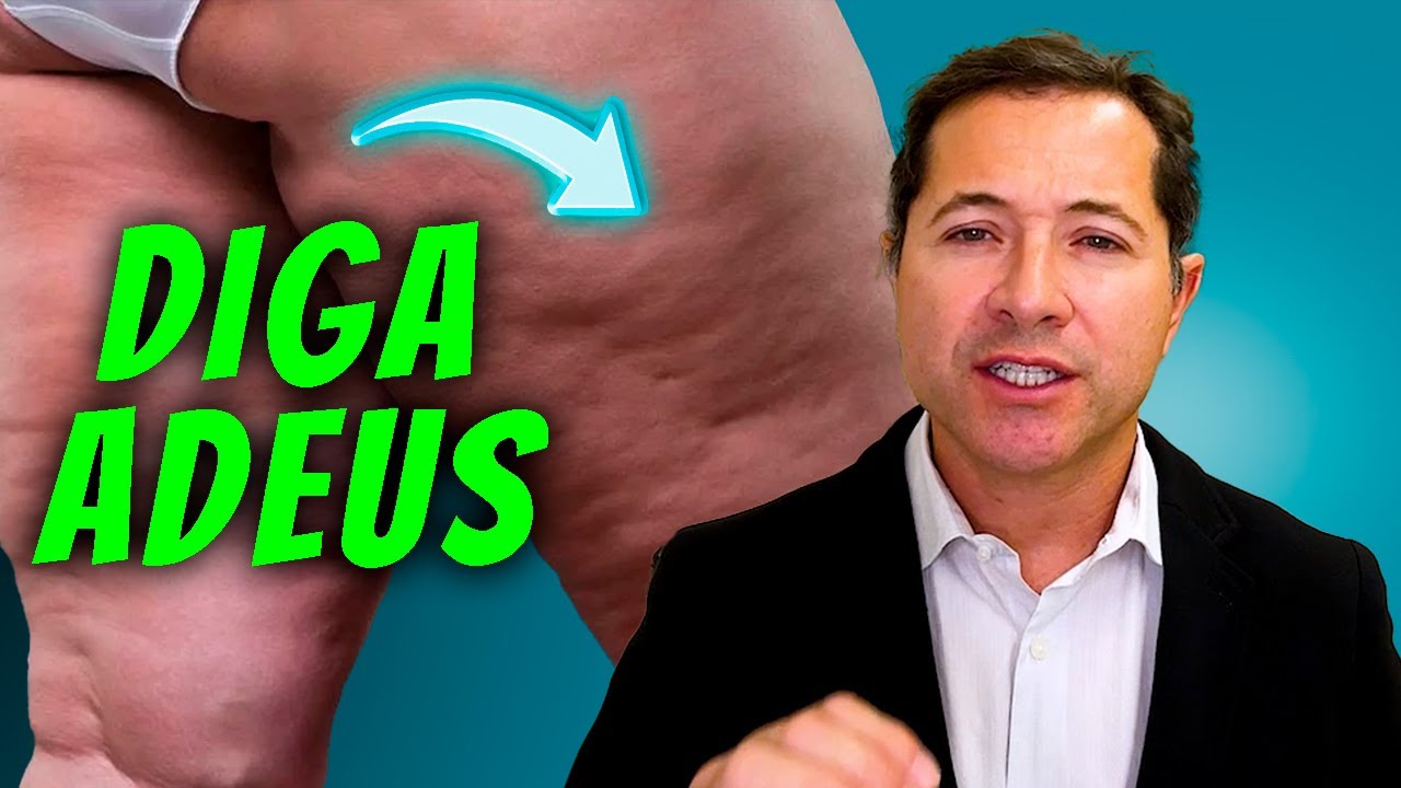 Diga Adeus à Inflamação com Estes 10 Alimentos Naturais!