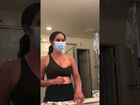 Accessing port by yourself