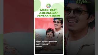 MASIH BAYI, Ameena Idap Penyakit Eksim Riwayat Keturunan Atta Halilintar, Gatal-gatal Tak Terkontrol