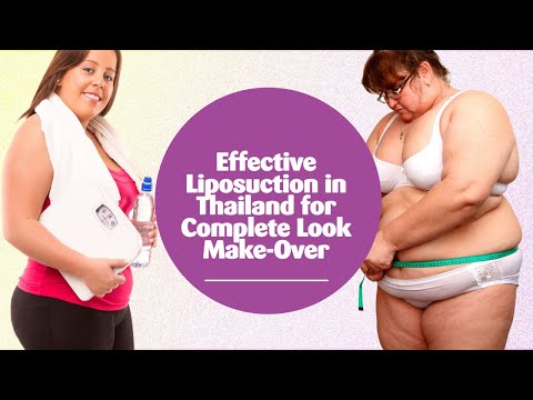 Effective Liposuction in Thailand for Complete Look Make-Over