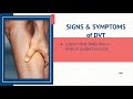 Could Your Leg Pain Be DVT